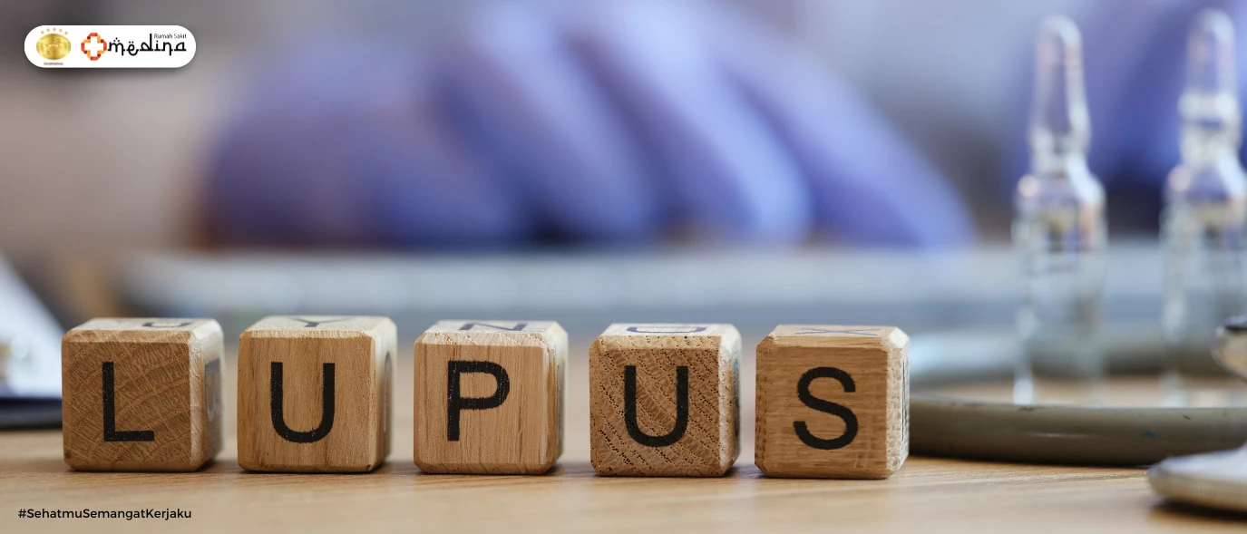 Mengenal Penyakit Lupus